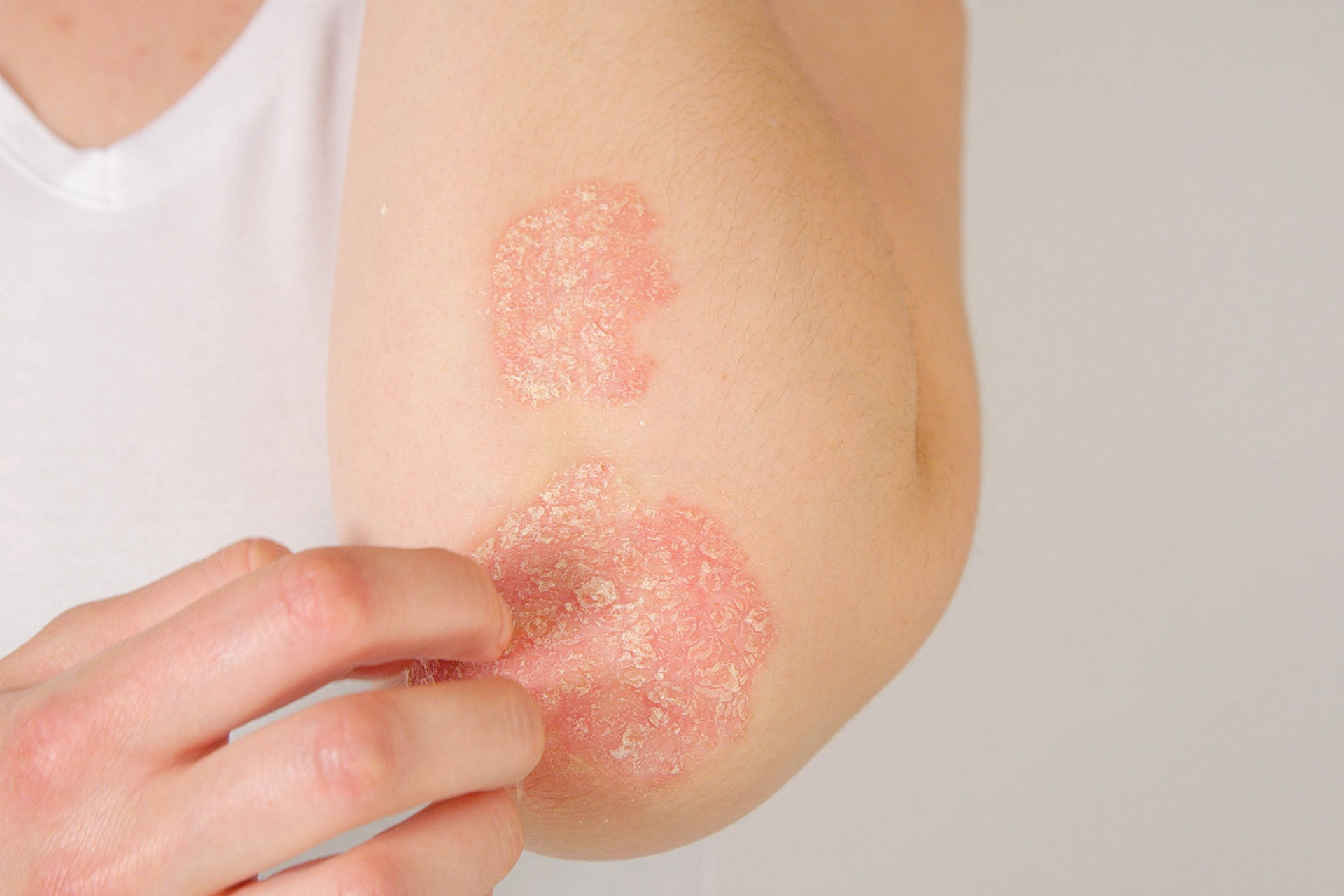 files/Dateien/Bilder/bieber-dermatology-consulting-bdc-diagnostic-allergy-therapy-1920x1280px.jpg